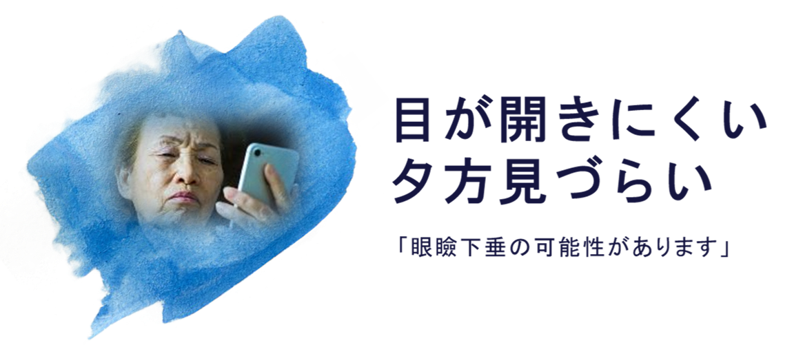 眼瞼下垂とは 眼瞼下垂とは