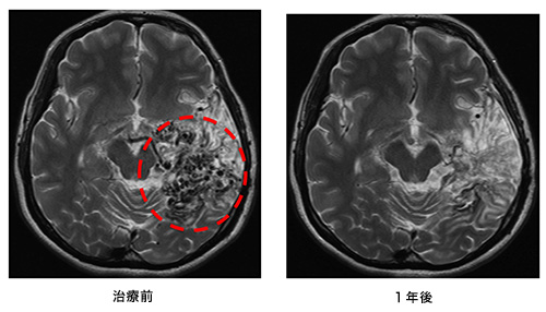 avm_slide3