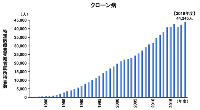 IBDクローン病