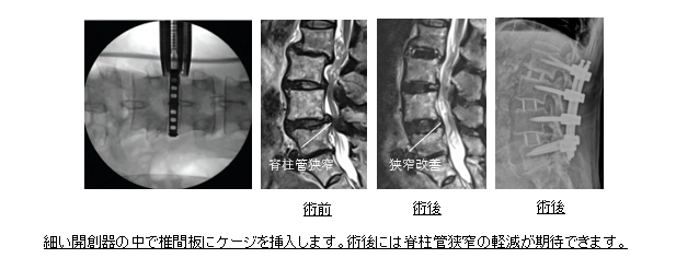 タイトルなし3
