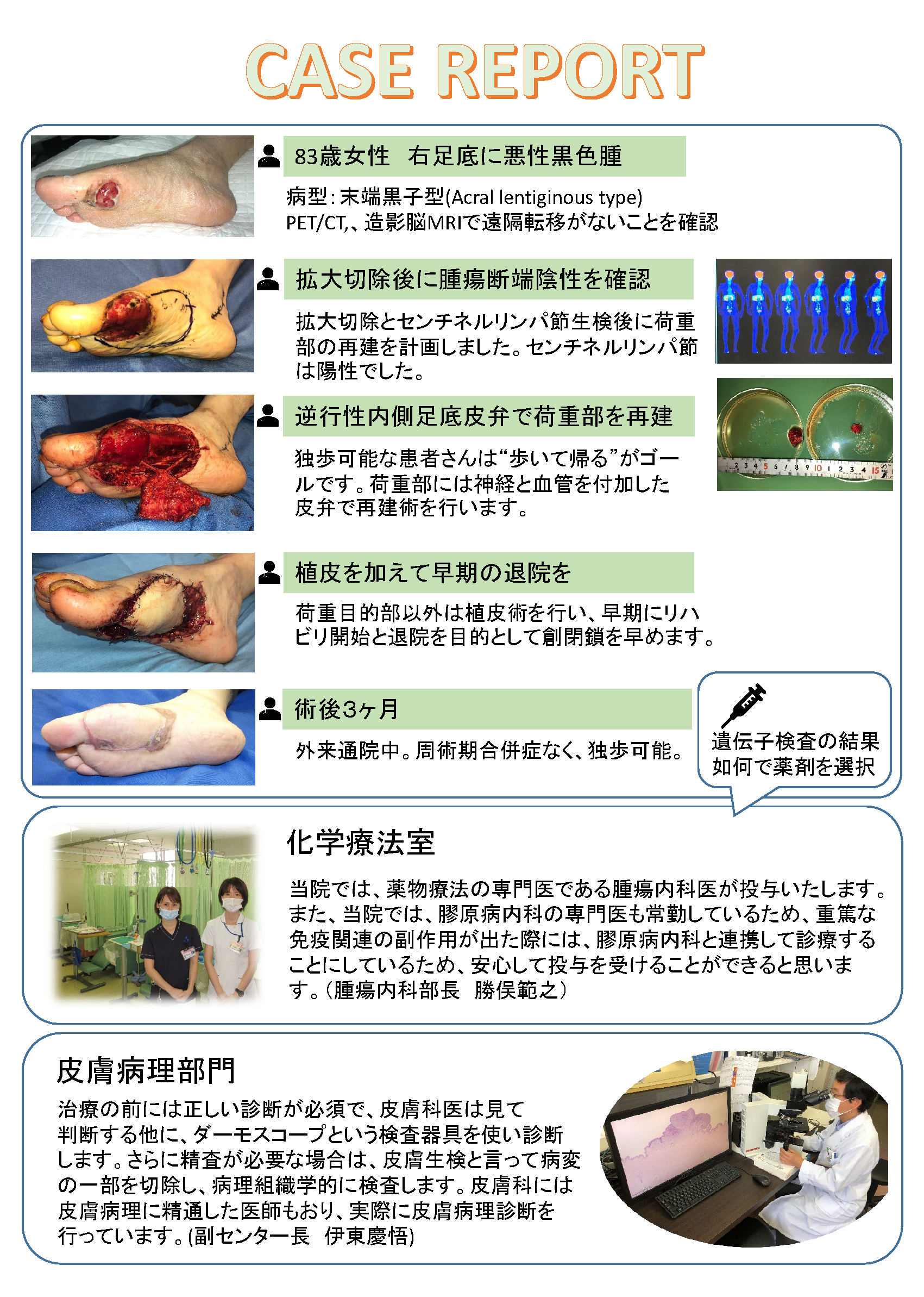 皮膚がんセンターチラシ20200818_ページ_2 皮膚がんセンターチラシ20200818_ページ_2