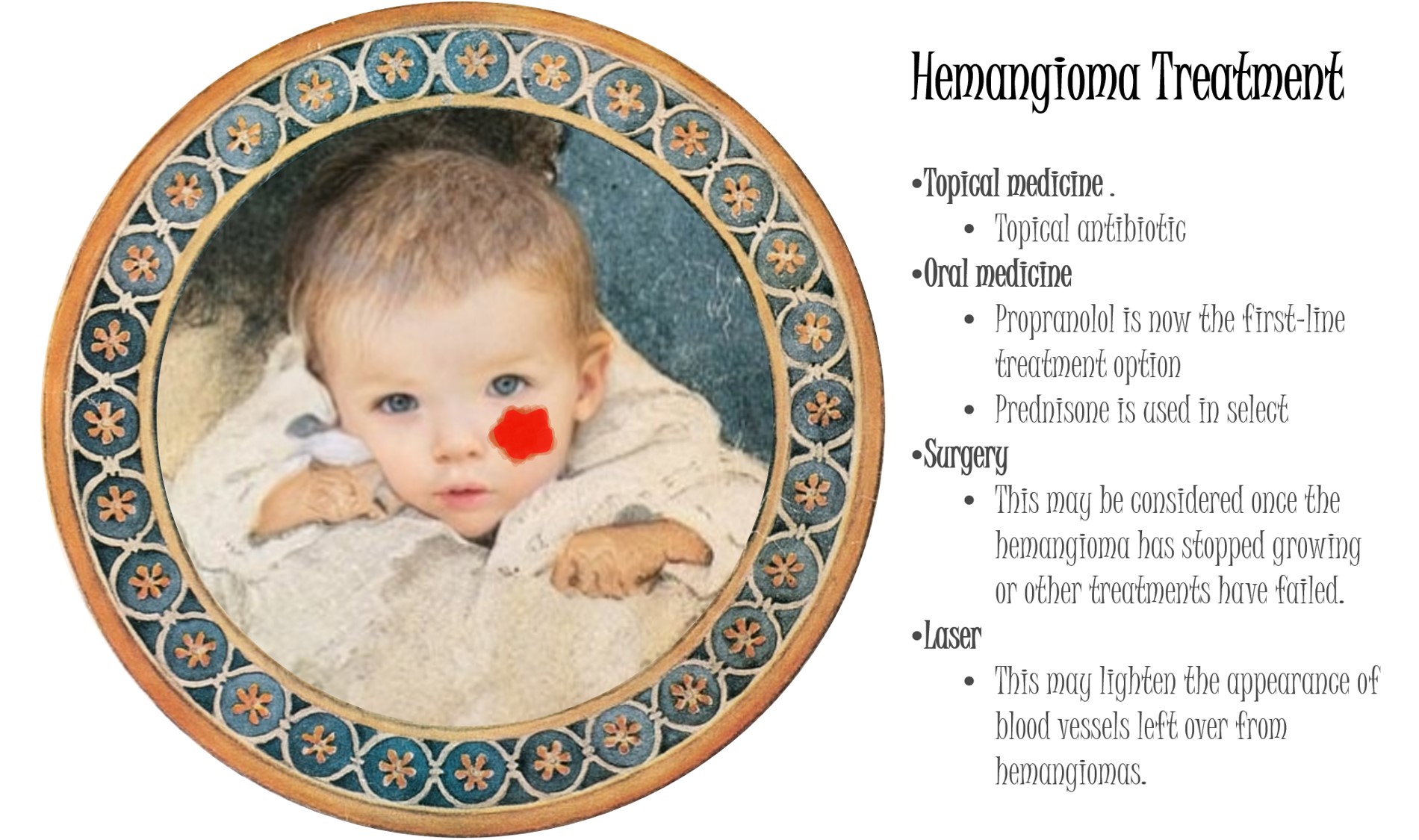 血管腫の原因・症状・治療法を解説 血管腫の原因・症状・治療法を解説