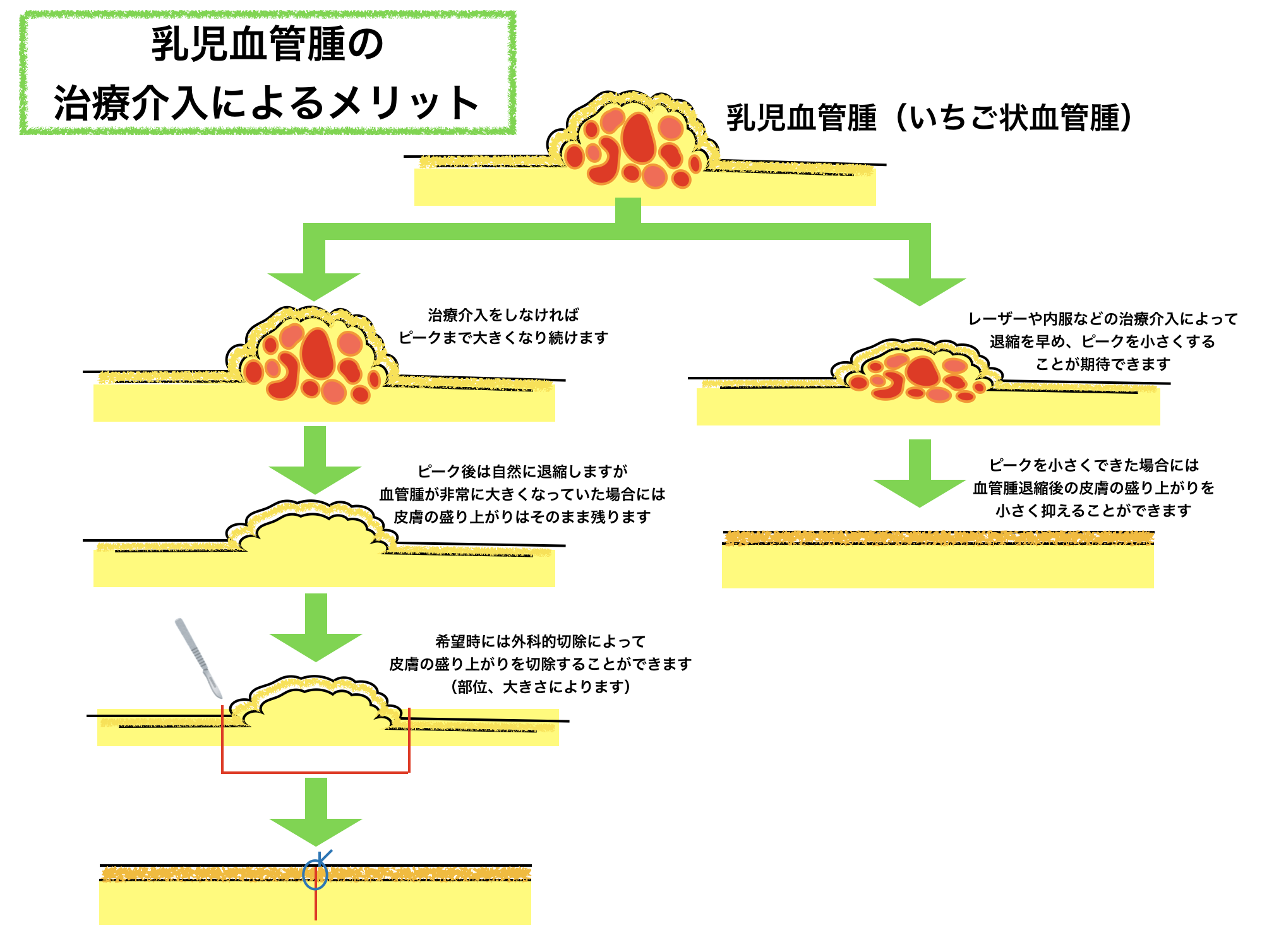 乳児血管腫2 乳児血管腫2