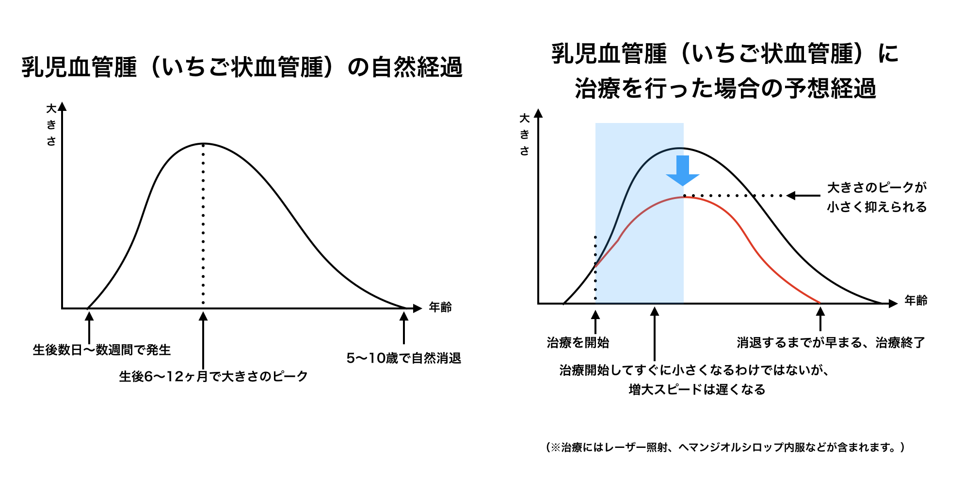 乳児血管腫3 乳児血管腫3