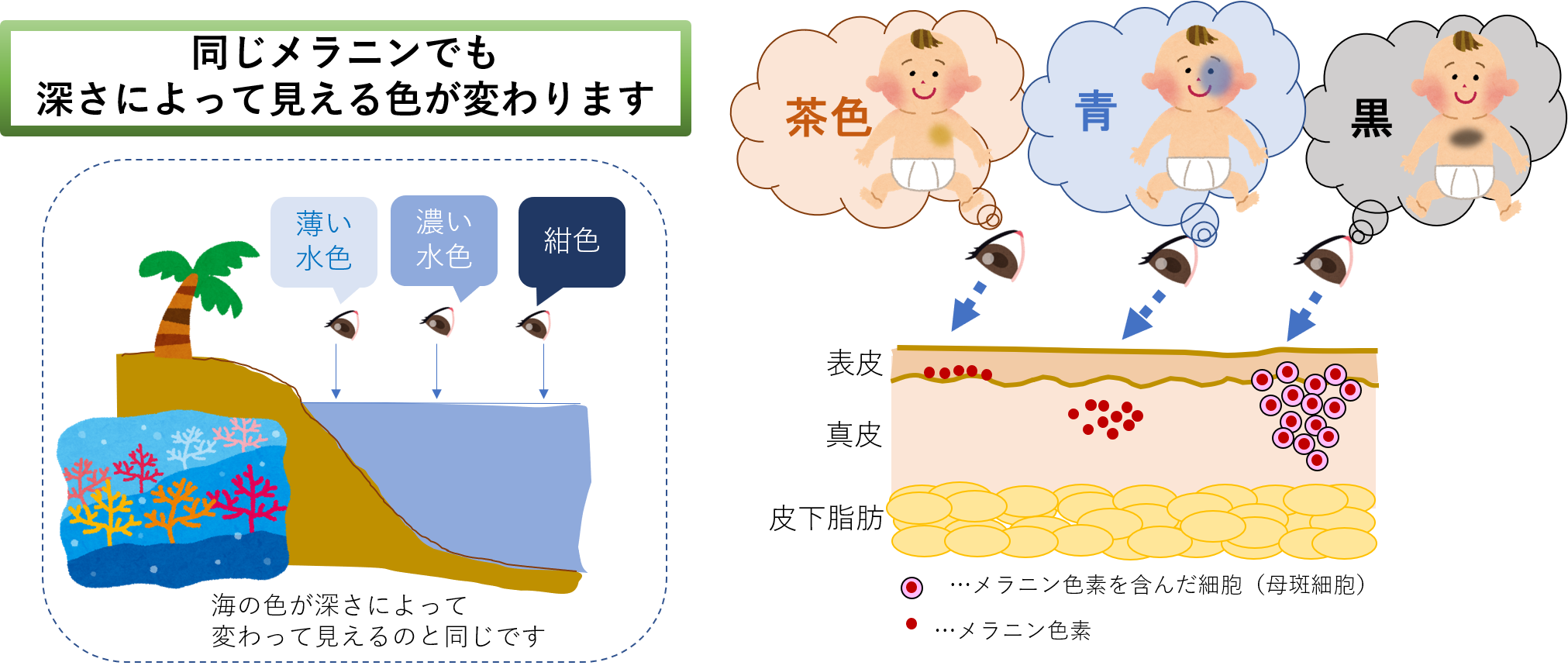 青あざの正体とは 青あざの正体とは