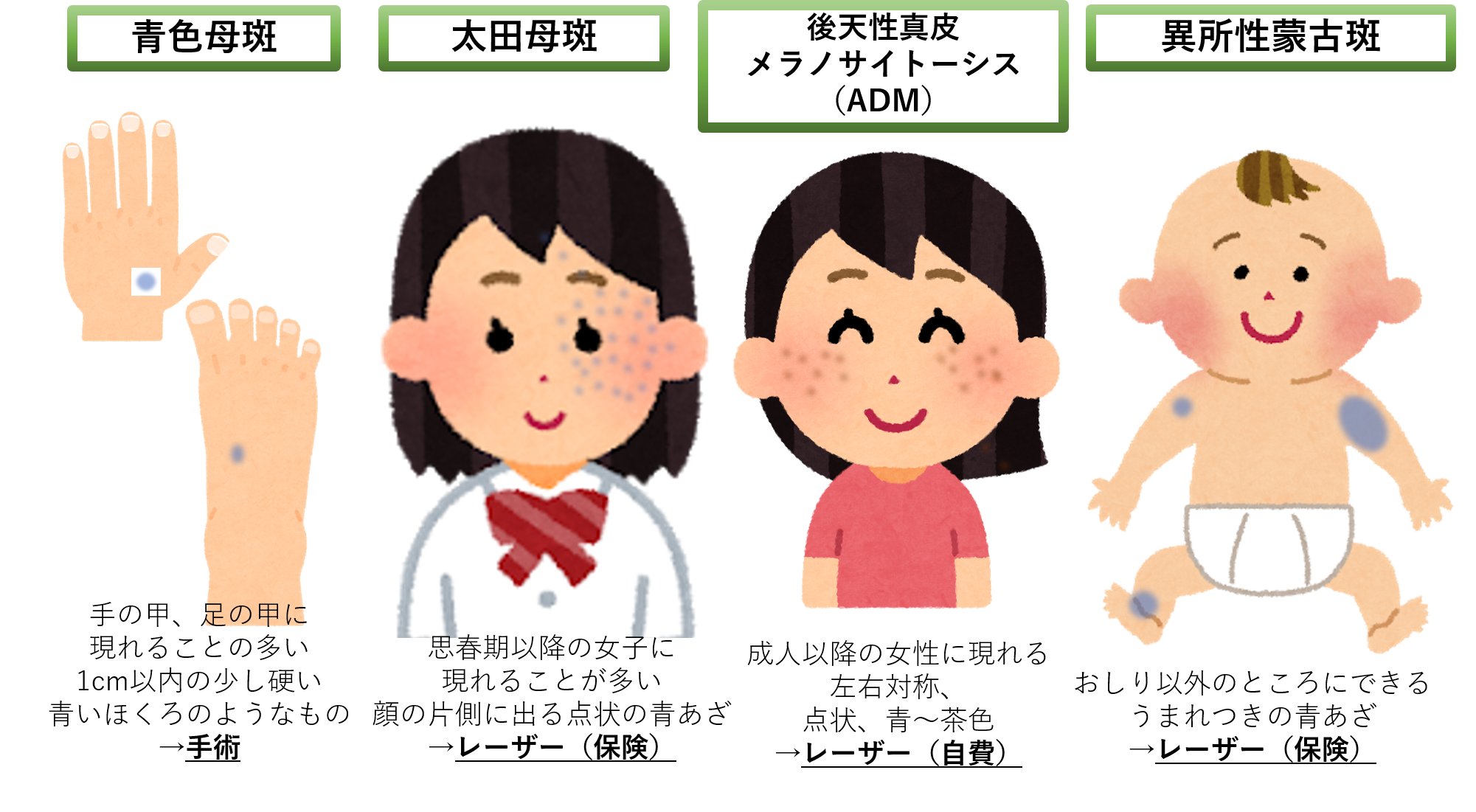 青あざの種類 青あざの種類