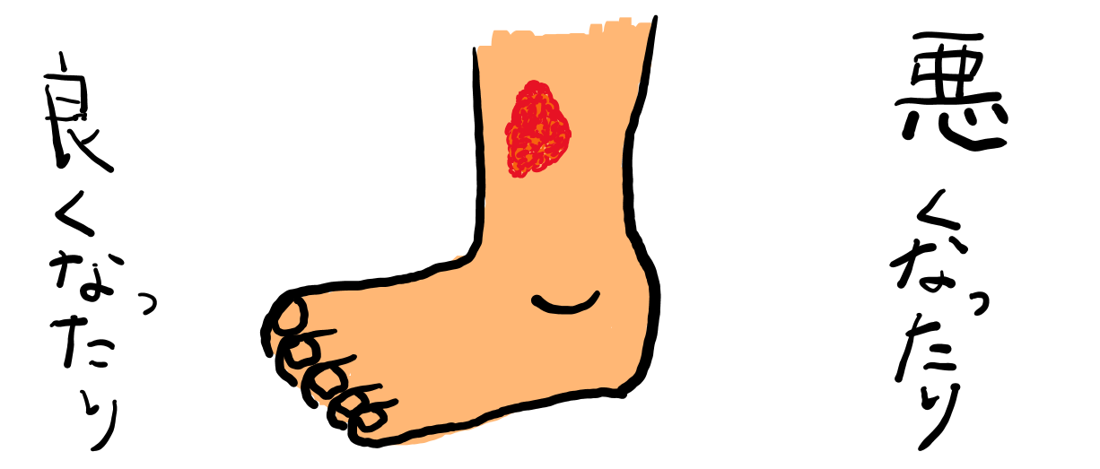 かいよう1 かいよう1