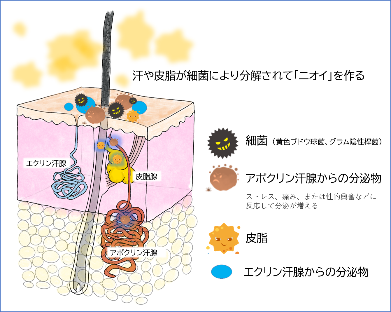 ワキガのニオイの原因(アポクリン汗腺分泌物と細菌) ワキガのニオイの原因(アポクリン汗腺分泌物と細菌)