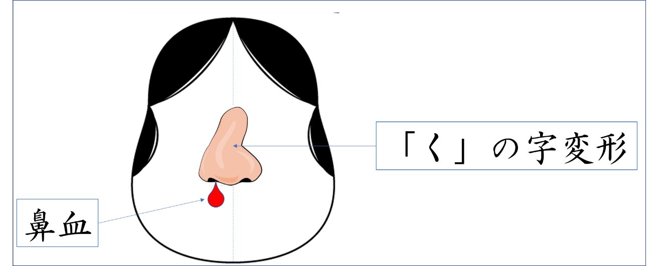 症状は何があるの? 症状は何があるの?