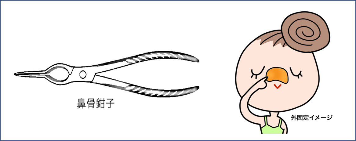 手術はどうするの? 手術はどうするの?