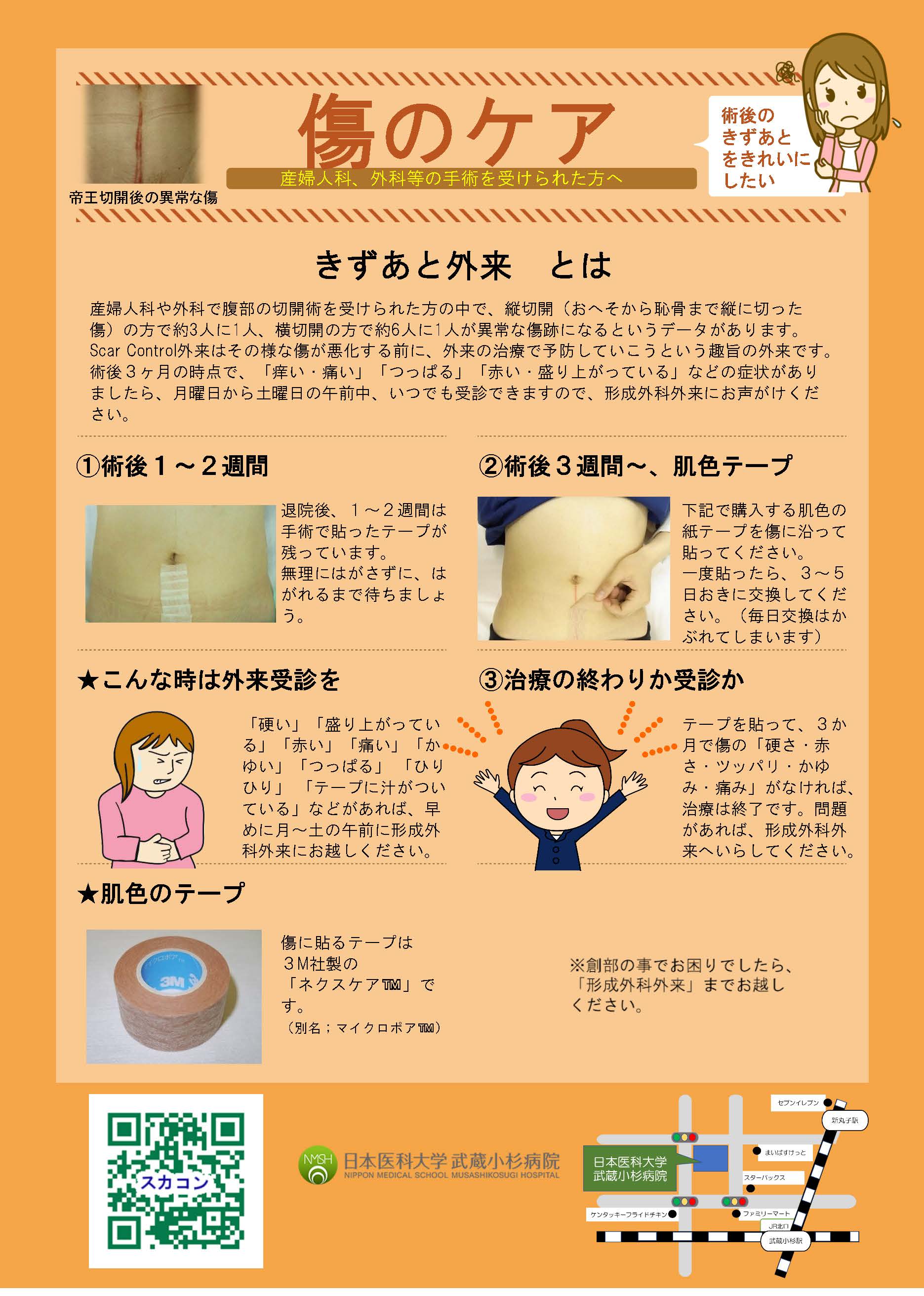 他科手術後のケア 他科手術後のケア