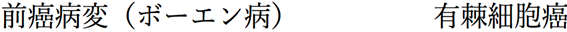 有棘細胞癌201205-2 有棘細胞癌201205-2