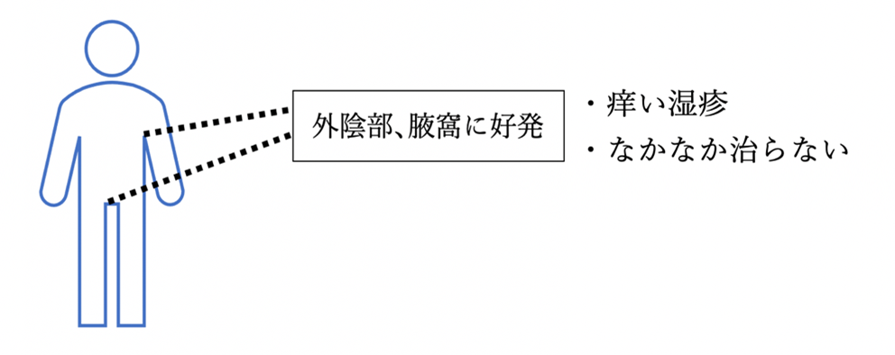 乳房外パジェット病 乳房外パジェット病