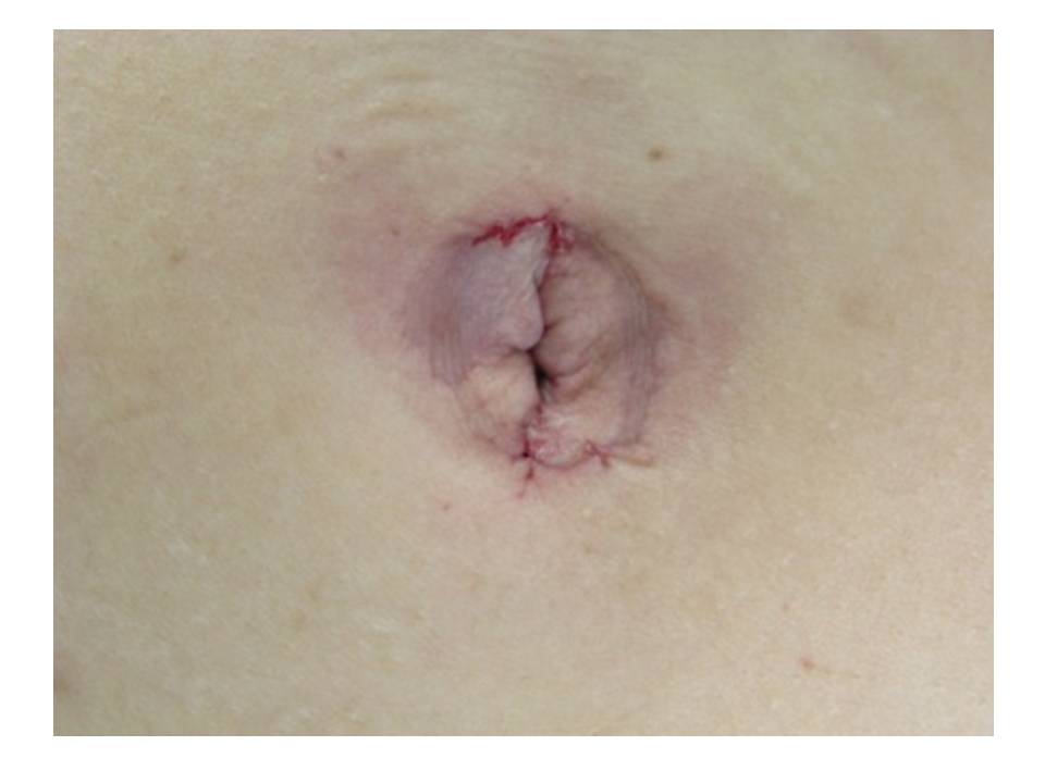 図3 術前 図3 術前