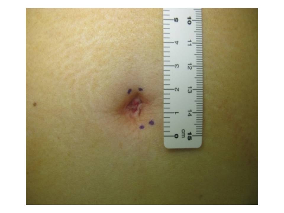 図4 術後 図4 術後